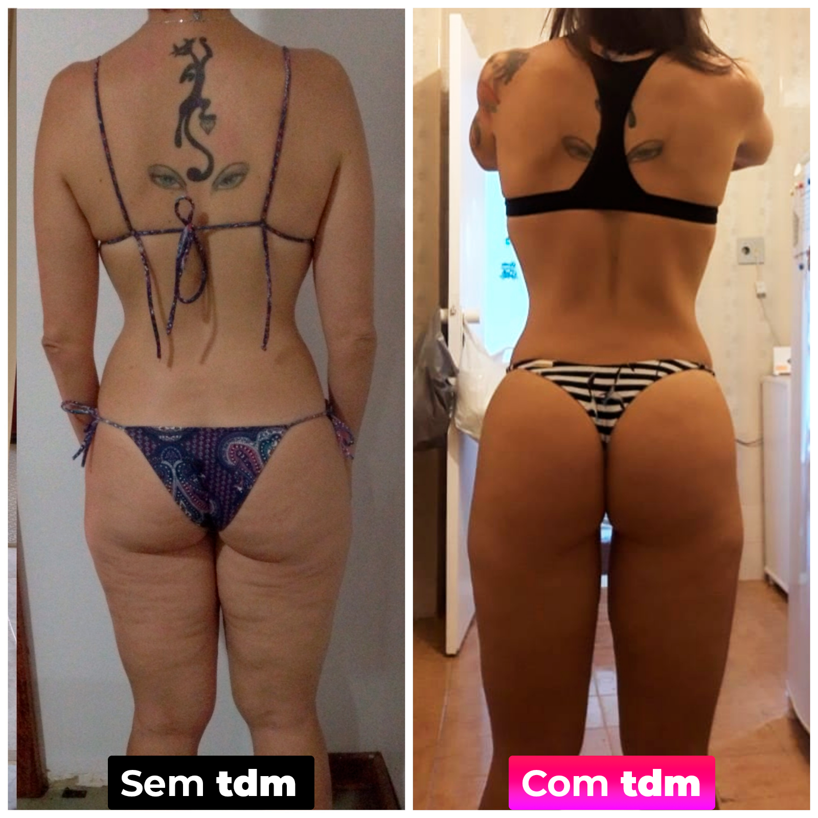 Antes e depois da tdm 6