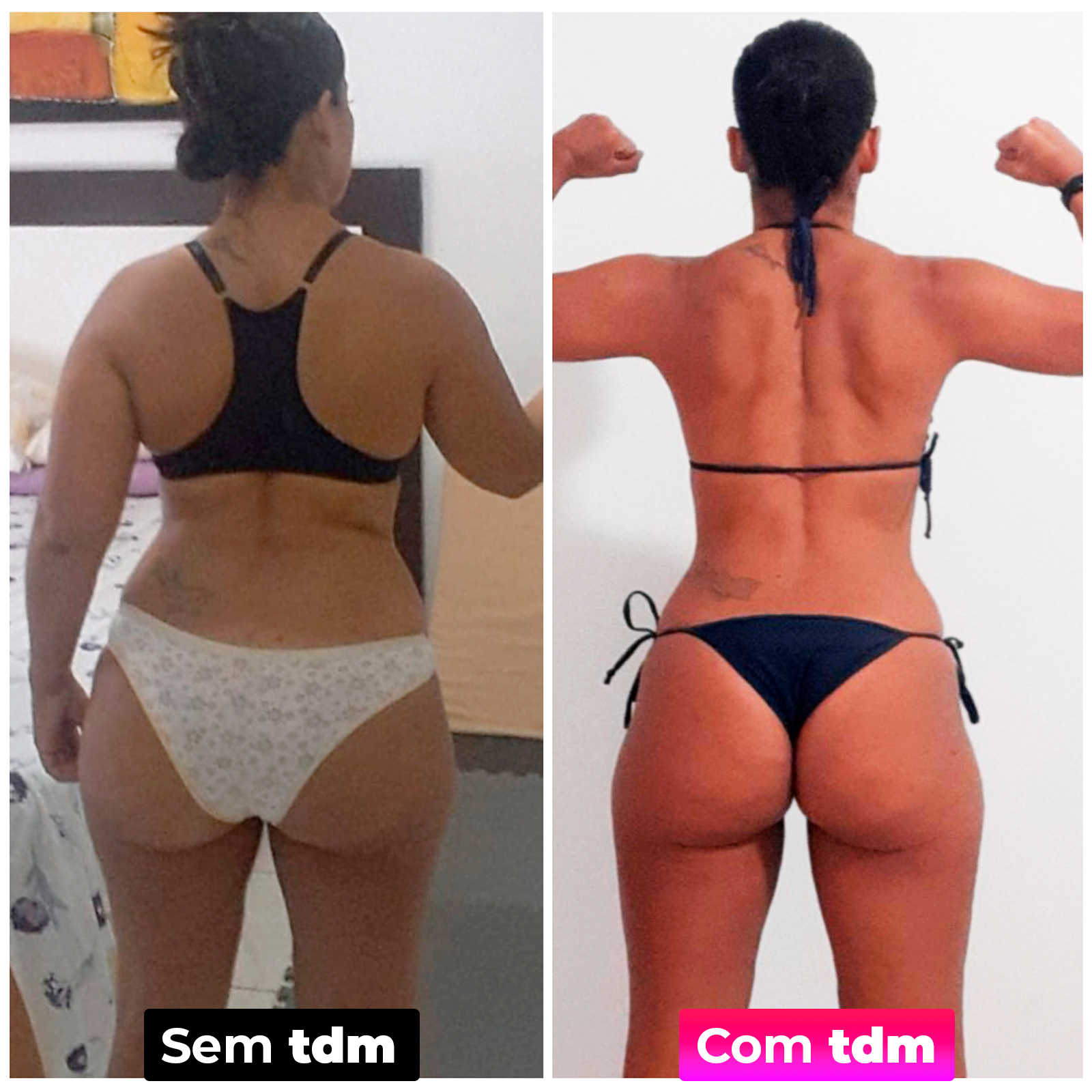 Antes e depois da tdm 2