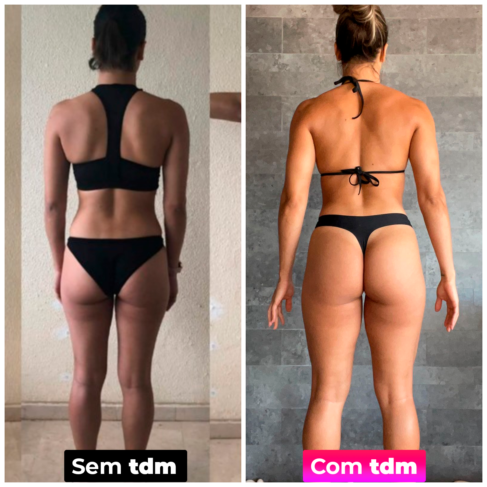 Antes e depois da tdm 4