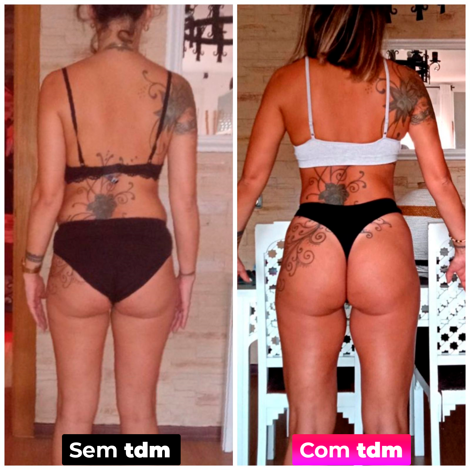 Antes e depois da tdm 5