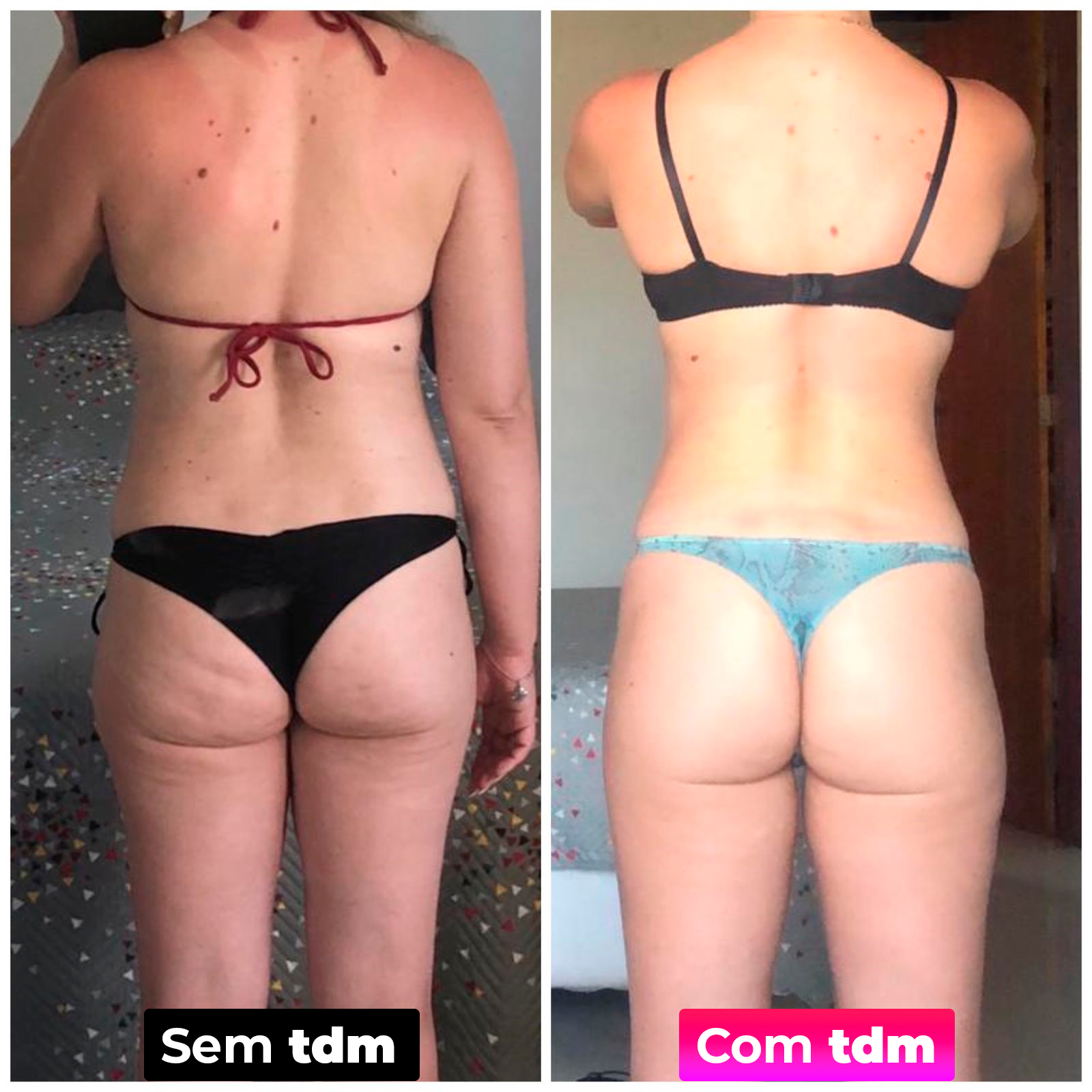 Antes e depois da tdm 7